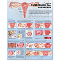 Trastornos Gynecológicos Frecuentes Tabla Anatómica